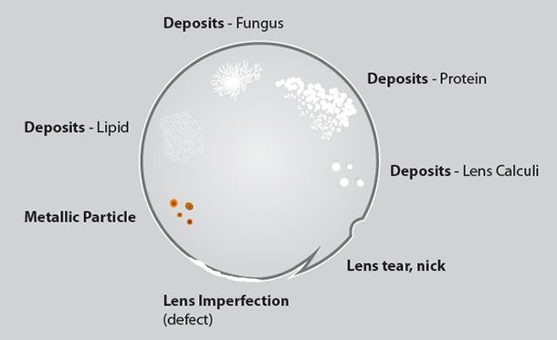 Clinical Contact Lens Management Guide